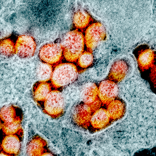 Transmission Electron Microscope Image of virus that causes COVID-19