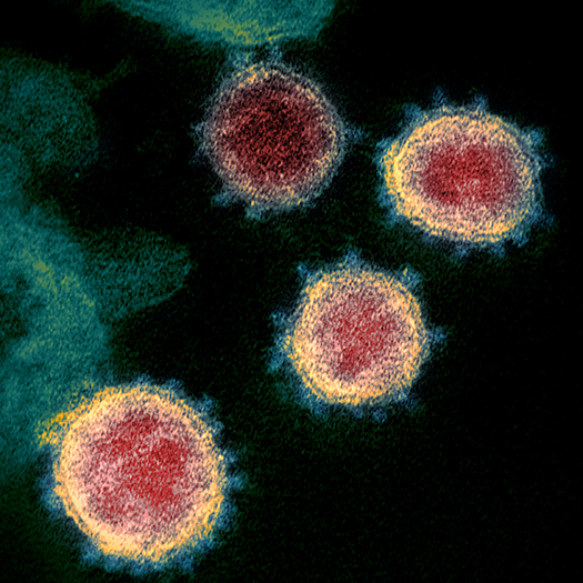 Transmission Electron Microscope image of Novel Coronavirus