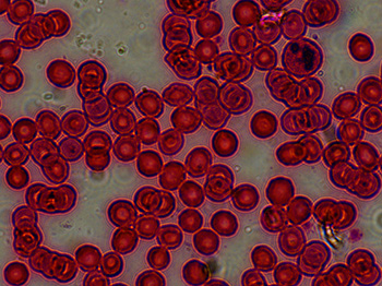 100x motic panthera lens blood smear