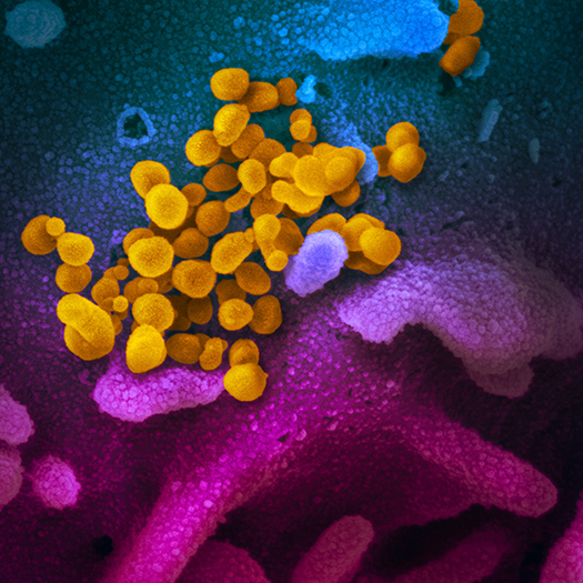 SEM Image of Virus that Causes COVID-19