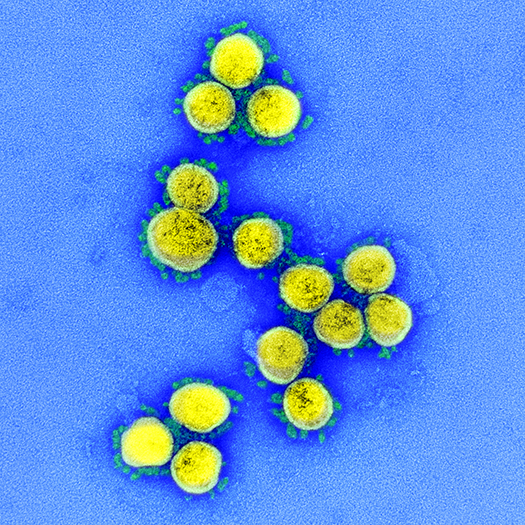 electron microscope images color virus