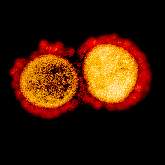 virus electron microscope color