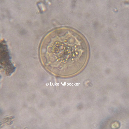 Arcella under the Microscope at 400x Arcella under the Microscope at 400x