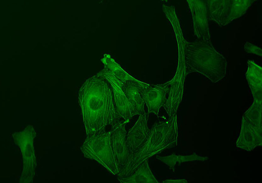 Fluorescence Microscopy U2OS Cells using GFP under Zeiss Primovert Inverted Microscope Fluorescence Microscopy U2OS Cells using GFP