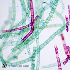Spirogyra prepared microscope slide under the microscope Spirogyra under the microscope.