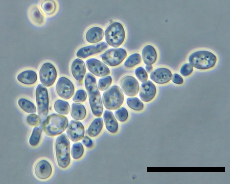 Yeast cells under the microscope Yeast cells under the microscope