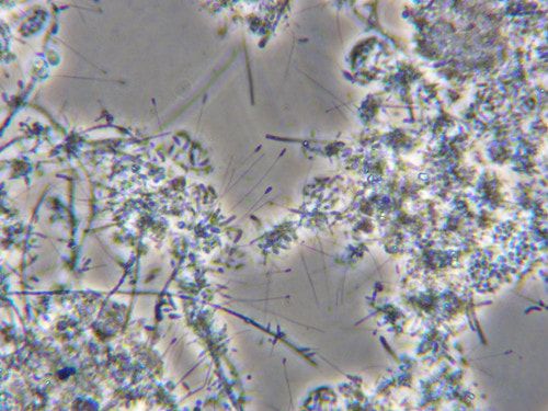 Hyphomicrobium under the Microscope Hyphomicrobium under the Microscope