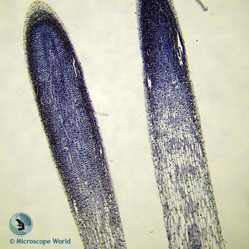 mitosis of onion root tip 40x microscope magnification mitosis of onion root tip 40x microscope magnification