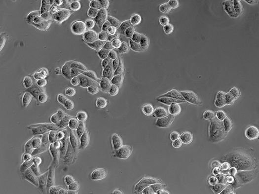 HeLa Cells Captured under Zeiss Primovert Phase Inverted Microscope HeLa Cells Captured under Zeiss Primovert Phase Inverted Microscope