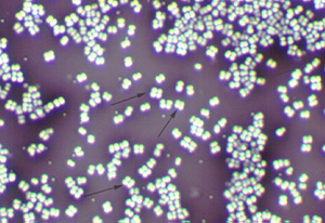 Tetrad under darkfield microscope Tetrad under darkfield microscope